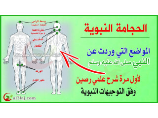 افضل مركز حجامة في بيلا.الديبة