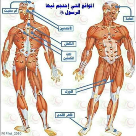 mrkz-alhdad-llhgam-alaalagy-byla-aldyb-big-3