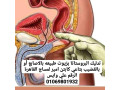 kabtn-amyr-lmsag47-snh-small-0